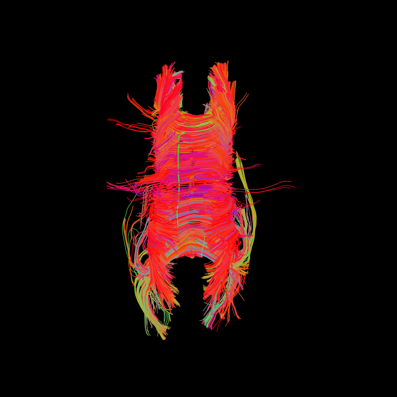 EuDX tractogram